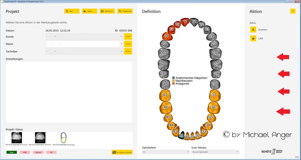 A neues Exocad im Win8_Design 1. Workflof
