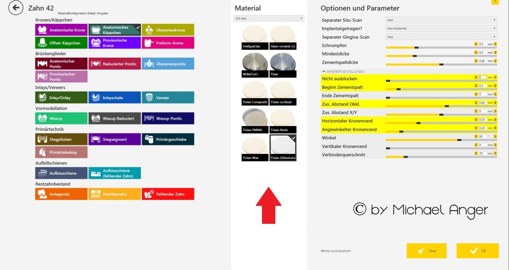 A neues Exocad im Win8_Design 2. Workflof