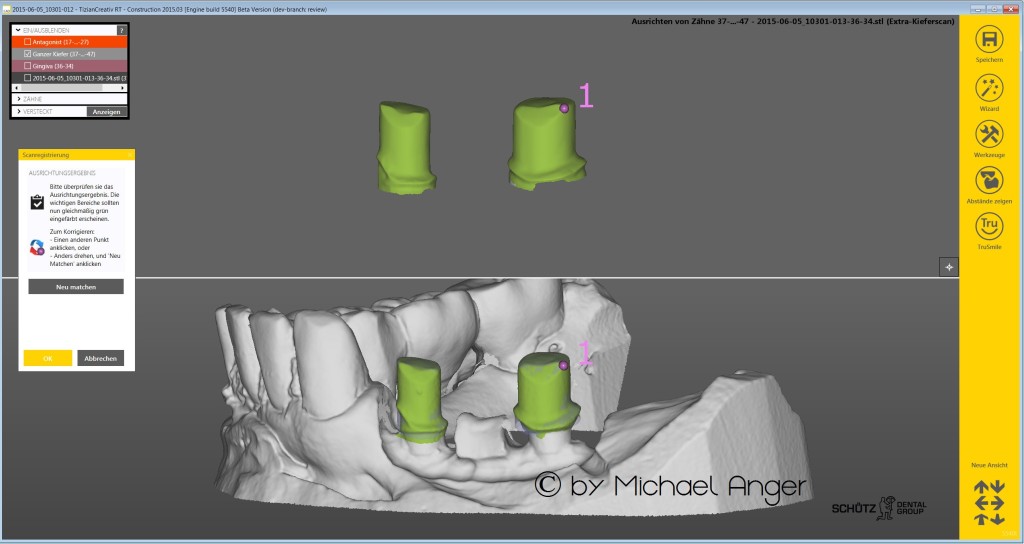 A3-Matching New Exocad Second Scan from Renishaw