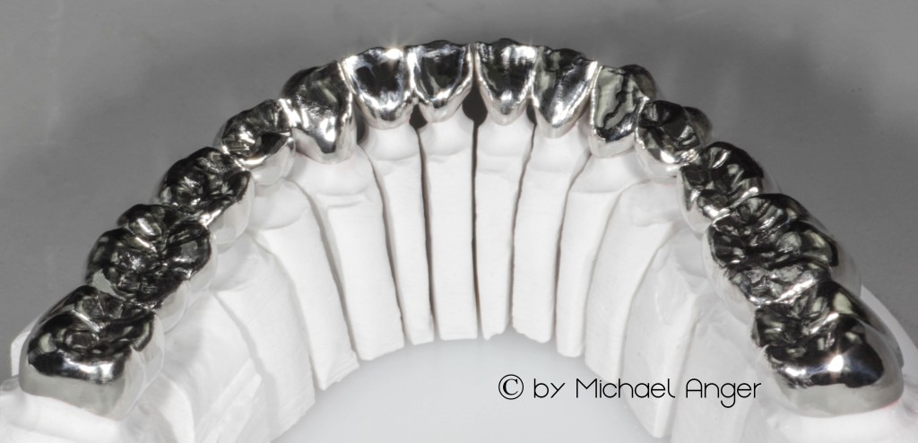 Fräsung Ronde Roh Zahntechnik Gerüste Kronen Brücken 2