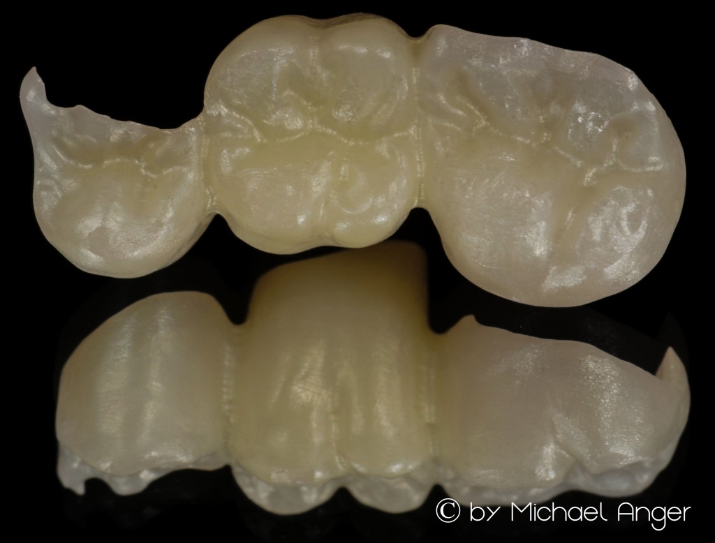 High transulcent zirconium Hochtransluzentes Zirkon 2s