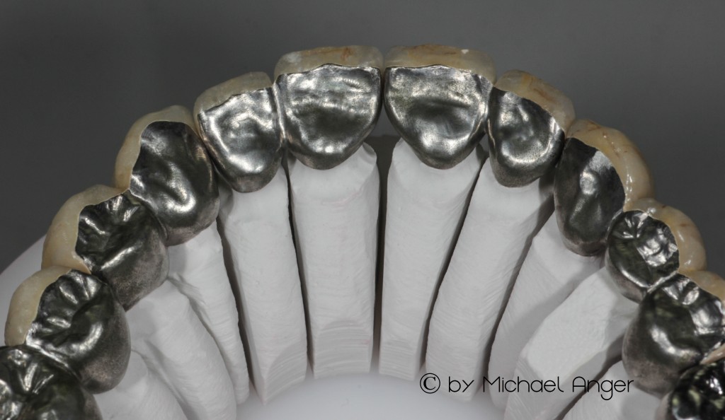 Rohbrand CAD-CAM Gerüste Kronen Brücken 2