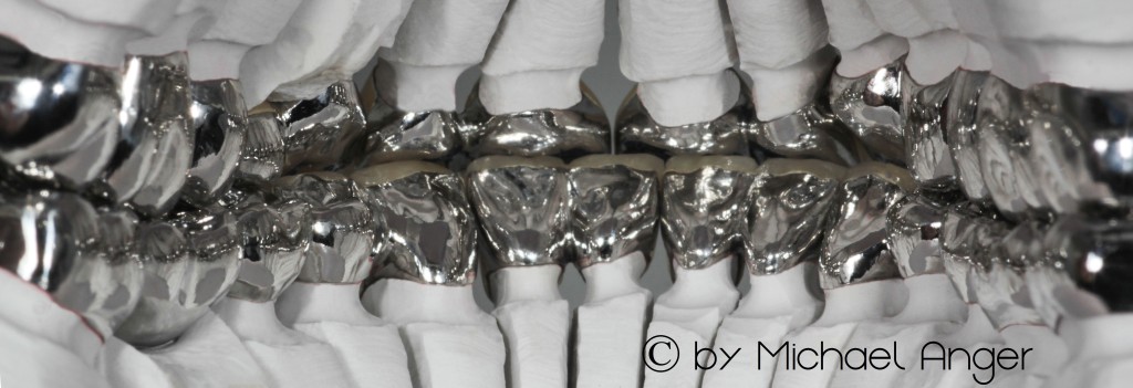 z-VMK & NEM Front Detailansicht-Oral-Filter