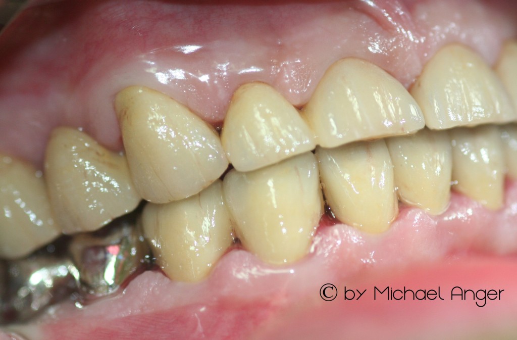 zz Mundaufnahme1 Signiert