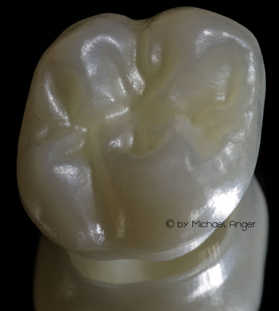 zzzzz translucent zirconium new dental material 1