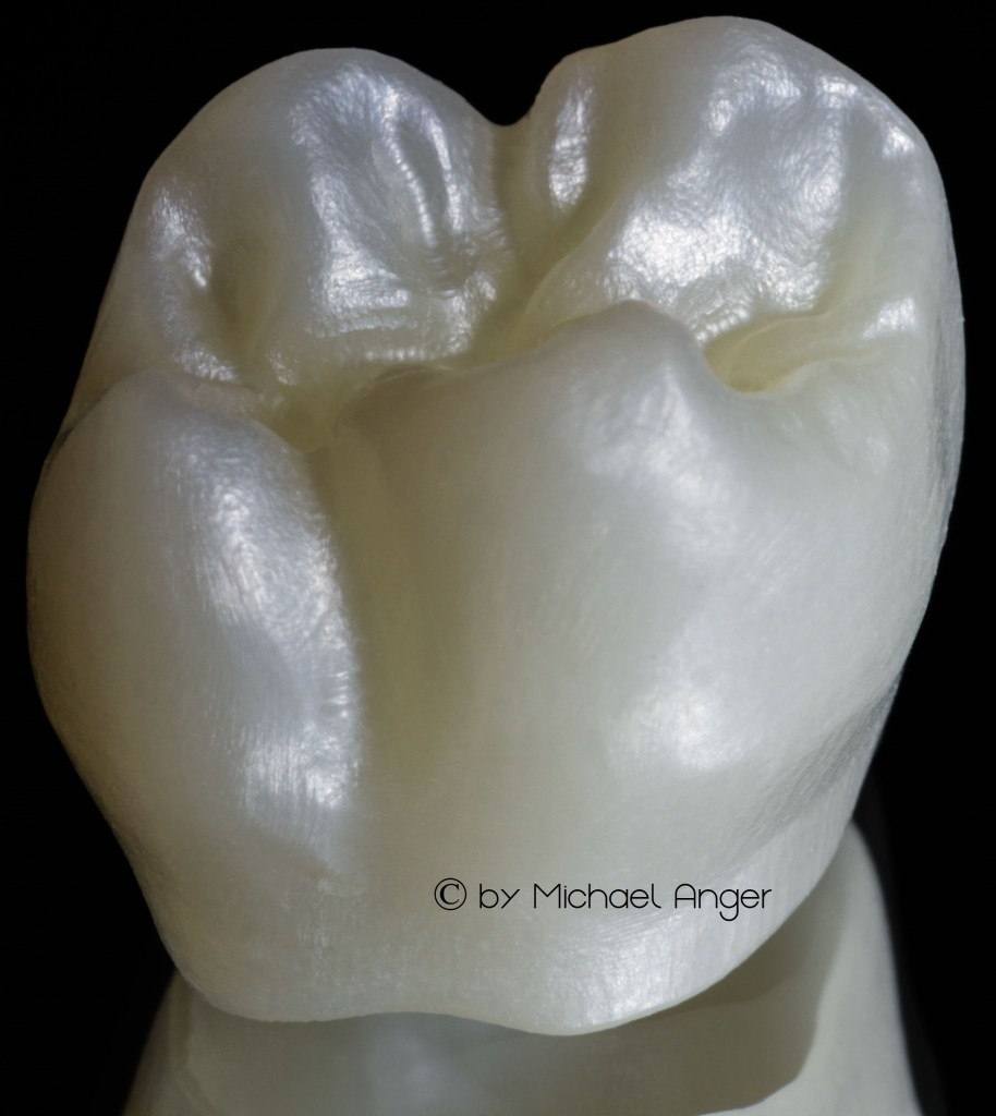 zzzzz translucent zirconium new dental material 2