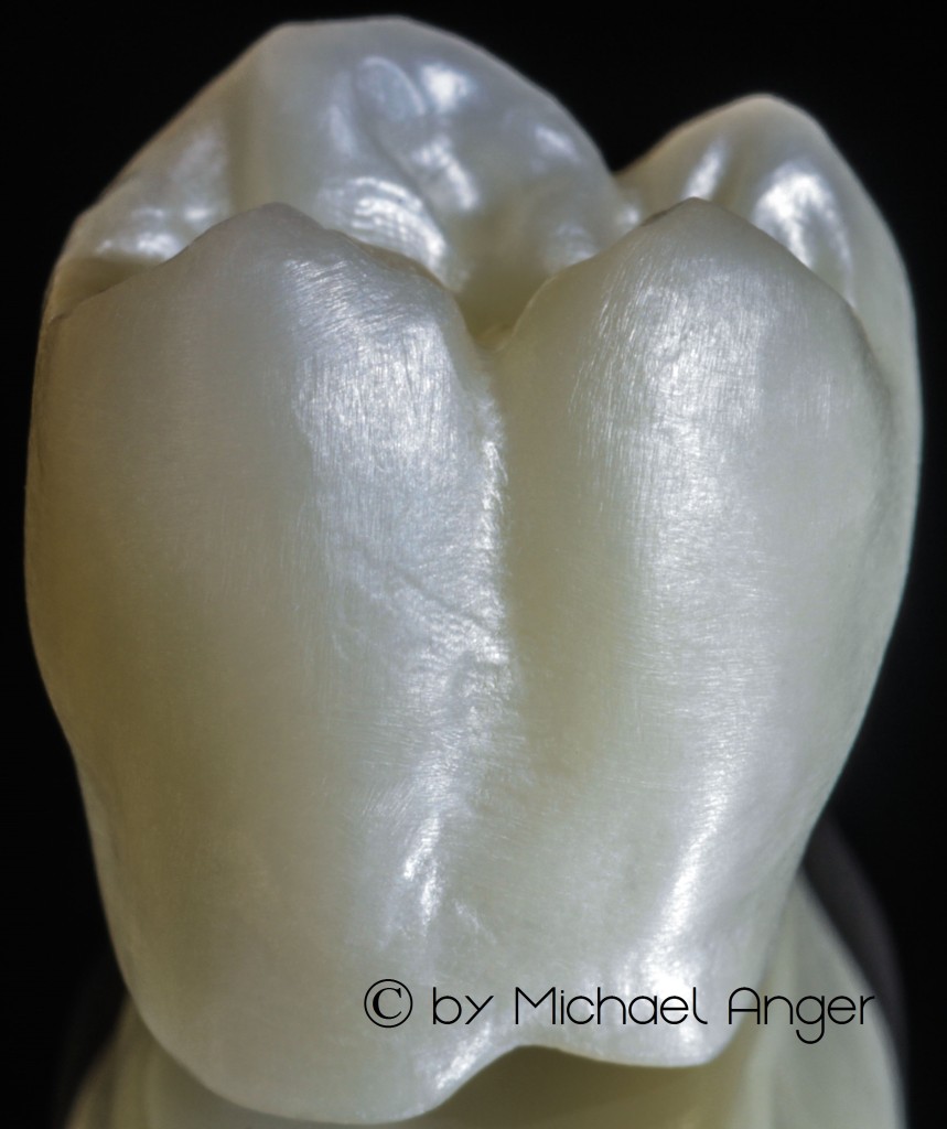 zzzzz translucent zirconium new dental material 3