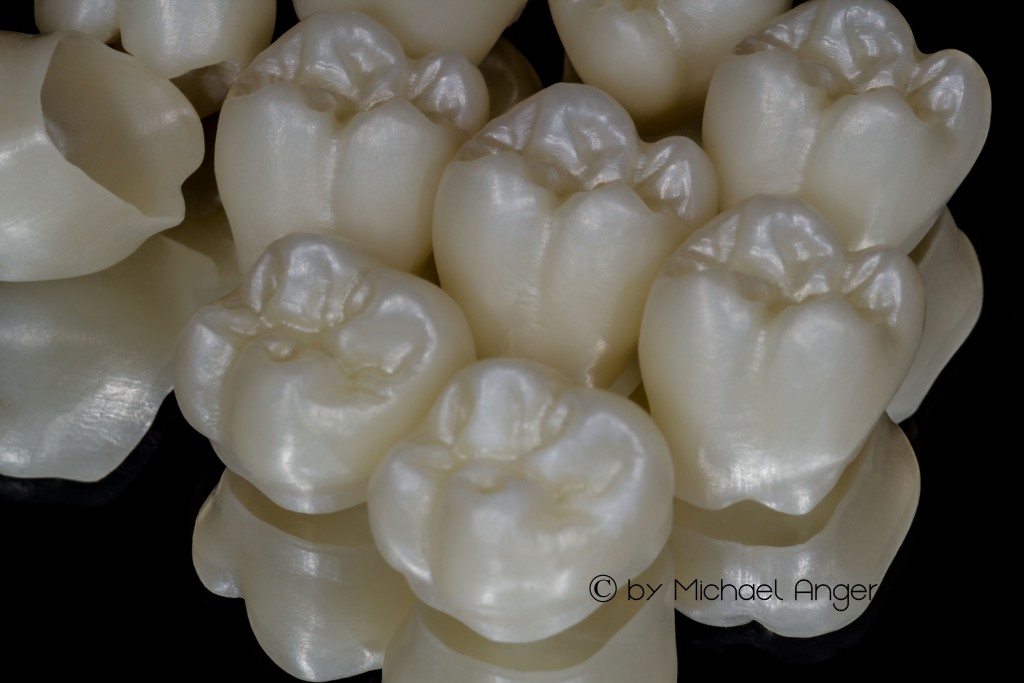 zzzzz translucent zirconium new dental material collage2