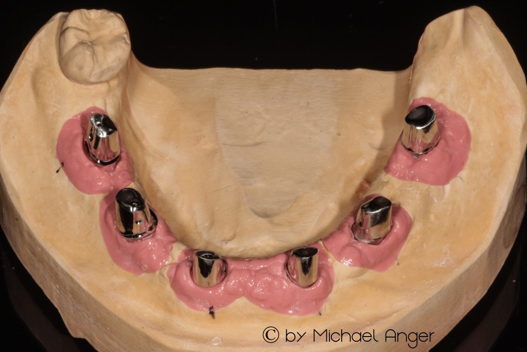 z gefräste Teleskope aus NEM milled telescopes from NP by CAD-CAM Ausgangssituation Modell signiert