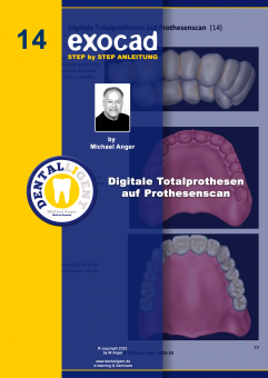 Exocad Step by Step Anleitung - Nr. 14 Digitale Totalprothesen auf Prothesenscan 