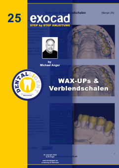 Exocad Step by Step Anleitung - Nr. 25 Wax Up´s & Verblendschalen 