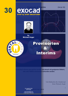 Exocad Step by Step Anleitung - Nr. 24 Digital die Kieferrelation vom Situ abnehmen 