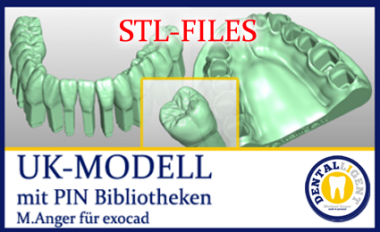 STL-FILES +  LIBRARY  - Upper jaw-MODELL with PIN- LIBRARY  for exocad by M. Anger 