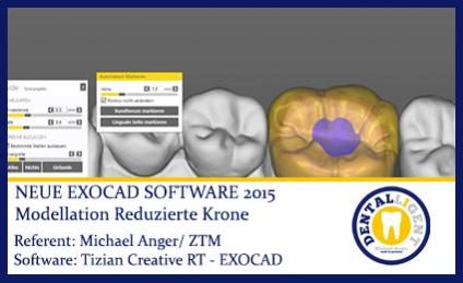 2015-Modellation einer reduzierten Krone - Exocad2015 