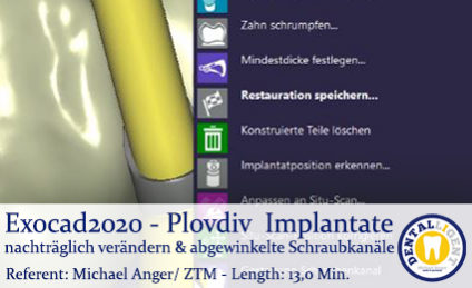 2020 EXOCAD - GRATIS Video - Exocad Plovdiv - Implantate nachträglich verändern & abgewinkelte Schraubkanäle 