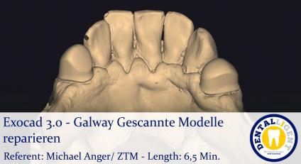 2021-Exocad - Exocad 3.0 – Galway Gescannte Modelle reparieren 