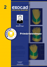 Exocad Step by Step Anleitung - Nr. 2 - Primärteleskope 