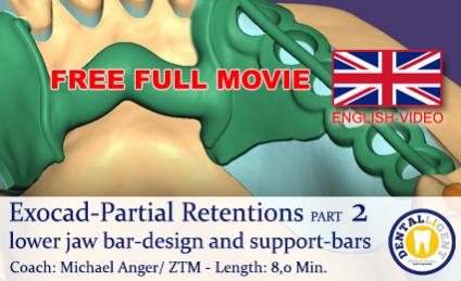 2019-FREE FULL TUTORIAL -Exocad-Partial lower jaw bar-design and support-bars 