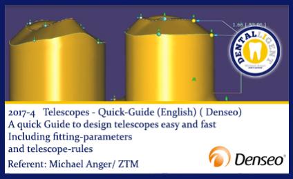 2017-ENGLISH -NEW EXOCAD TUTORIAL DENSEO -4 - Telescopes - Quick-Guide  (English) 