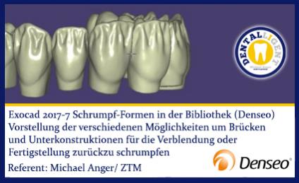 2017-NEW EXOCAD TUTORIAL DENSEO - 7 Schrumpf-Formen in der Bibliothek  (Denseo) 