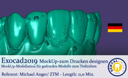 2020-Exocad - MockUp-zum Drucken designen 