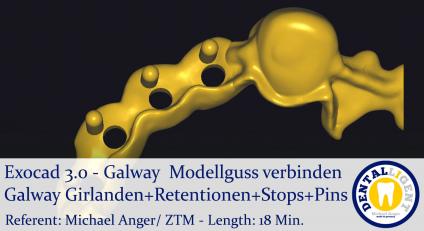 2021-Exocad - Exocad 3.0 – Galway  Modellguss verbinden-Gir-Ret-Stp-Pin 