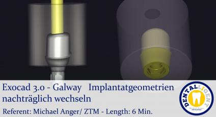 2021-Exocad - Exocad 3.0 – Galway Implantatgeometrien nachträglich wechseln 