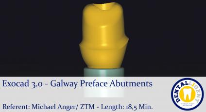 2021-Exocad 3.0 – Galway   Preface-Abutments 