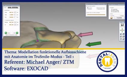 Model. funkt. Aufbissschiene mit Anatomie im TruSmile-Modus - Teil 1 