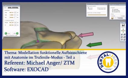 Model. funkt. Aufbissschiene mit Anatomie im TruSmile-Modus - Teil 2 