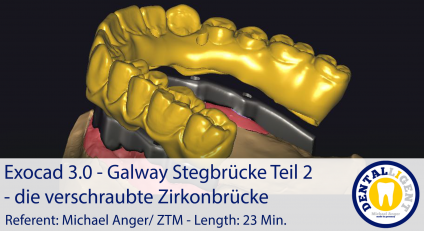 2021-Exocad 3.0 – Galway Stegbrücke Teil 2 - die verschraubte Zirkonbrücke 