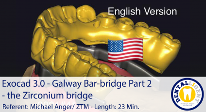 2021-Exocad - Exocad 3.0 – Galway Bar-bridge Part 2 - the Zirconium bridge 