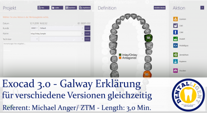 2021-Exocad - Exocad 3.0 - Galway Erklärung für verschiedene Versionen gleichzeitig 