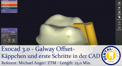 2021-Exocad - Exocad 3.0 – Galway Offset-Käppchen und erste Schritte in der CAD 