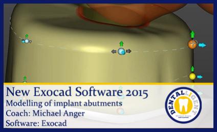 Modelling of implant abutments - english 