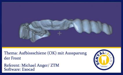 2016-NEW EXOCAD SOFTWARE TUTORIAL 2016 - Aufbissschiene (OK) mit Aussparung der Front Länge: 9min  Referent: Michael Anger Software EXOCAD 2016 