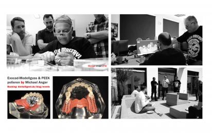 Exocad-Modellguss & PEEK polieren by Michael Anger 