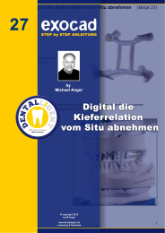 Exocad Step by Step Anleitung - Nr. 24 Digital die Kieferrelation vom Situ abnehmen 