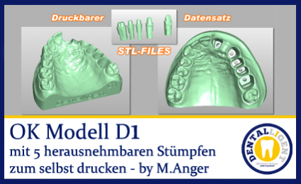 OK-Modell D1-STL Daten zum selbst drucken 