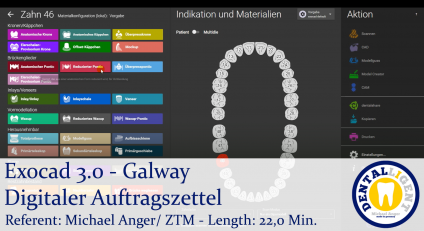 2021-Exocad - Exocad 3.0 -Galway - Digitales Auftragsblatt 