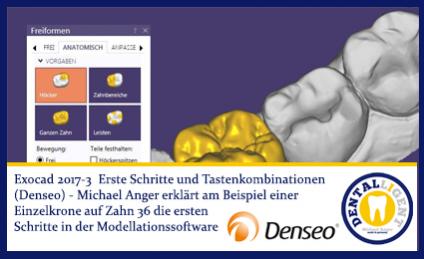 2017-NEW EXOCAD TUTORIAL DENSEO 2017-3 - Erste Schritte und Tastenkombinationen 