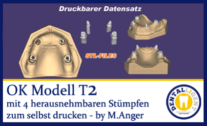 OK-Modell T2-STL-Daten zum selbst drucken 