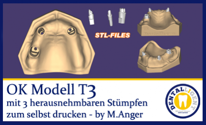 OK-Modell T3-STL-Daten zum selbst drucken 