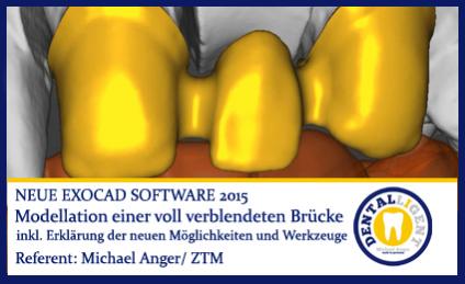 Modellation einer vollverblendeten Brücke 