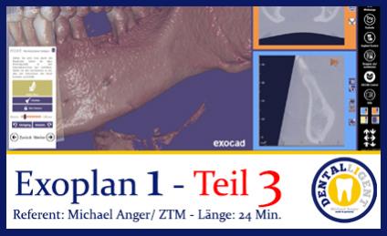 2019-Exocad  EXOPLAN 1 - Teil 3 