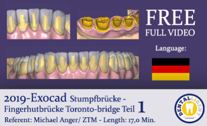 2019 FREE FULL TUTORIAL - EXOCAD - TORONTO-BRIDGE - Fingerhutbrücke 