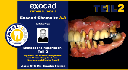 Exocad Chemnitz 3.3 - 2026-02 - Mundscans reparieren Teil 2 