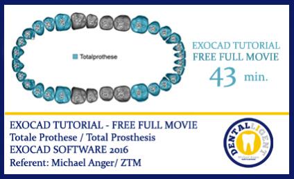 2016-EXOCAD TUTORIAL - FREE FULL MOVIE -  Totale Prothese / Total Prosthesis - EXOCAD SOFTWARE 2016 