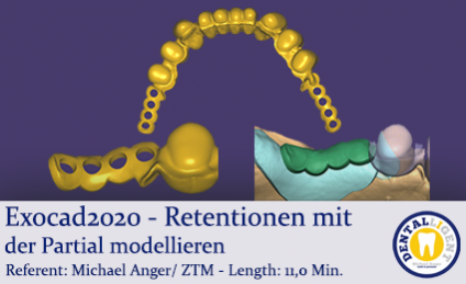 2020-Exocad - Exocad-Plovdiv – Retentionen mit der Partial modellieren 