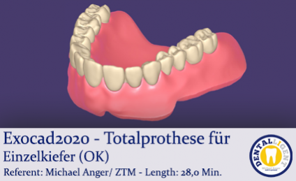 2020-Exocad - Exocad-Plovdiv – Totalprothese für Einzelkiefer (OK) 